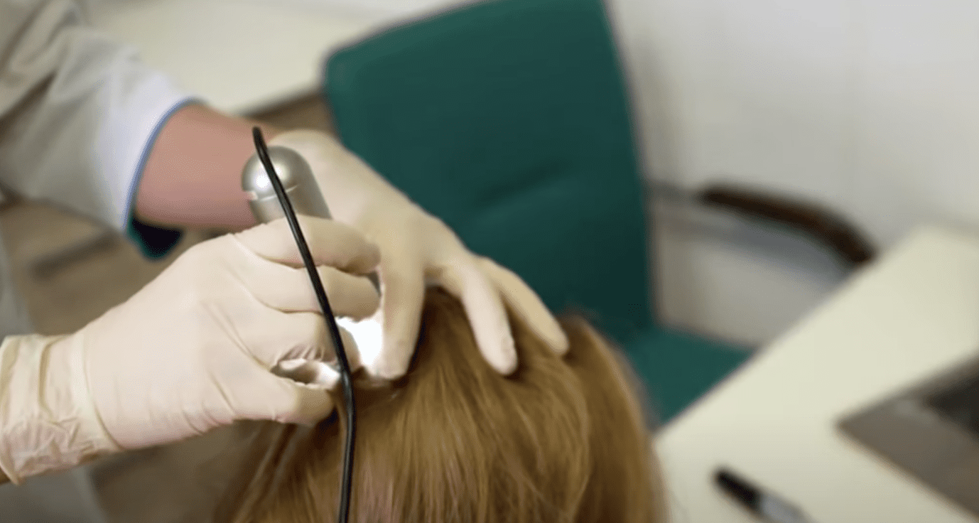 'From Thinning to Winning' looks at baldness breakthrough