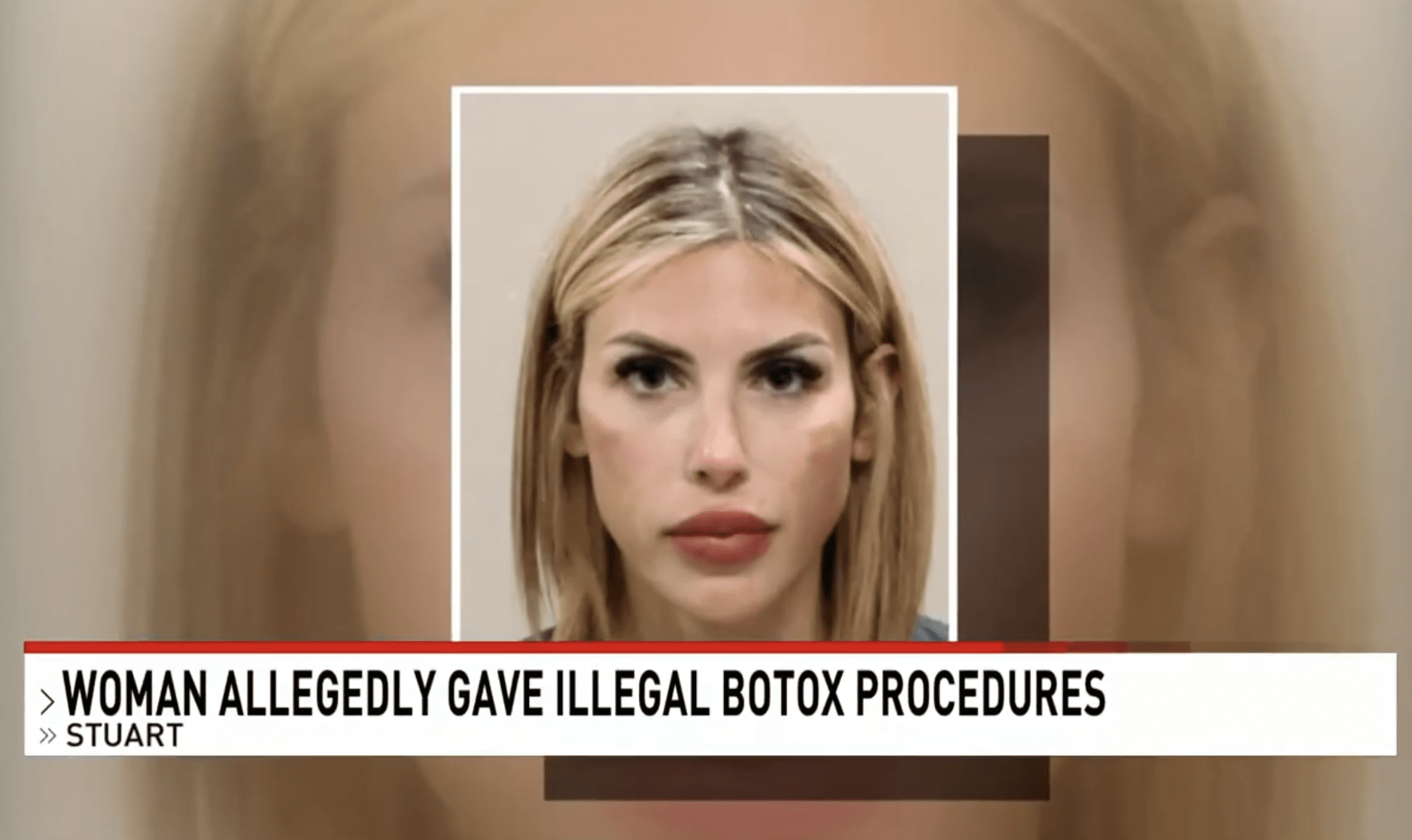 Unlicensed Botox Babe