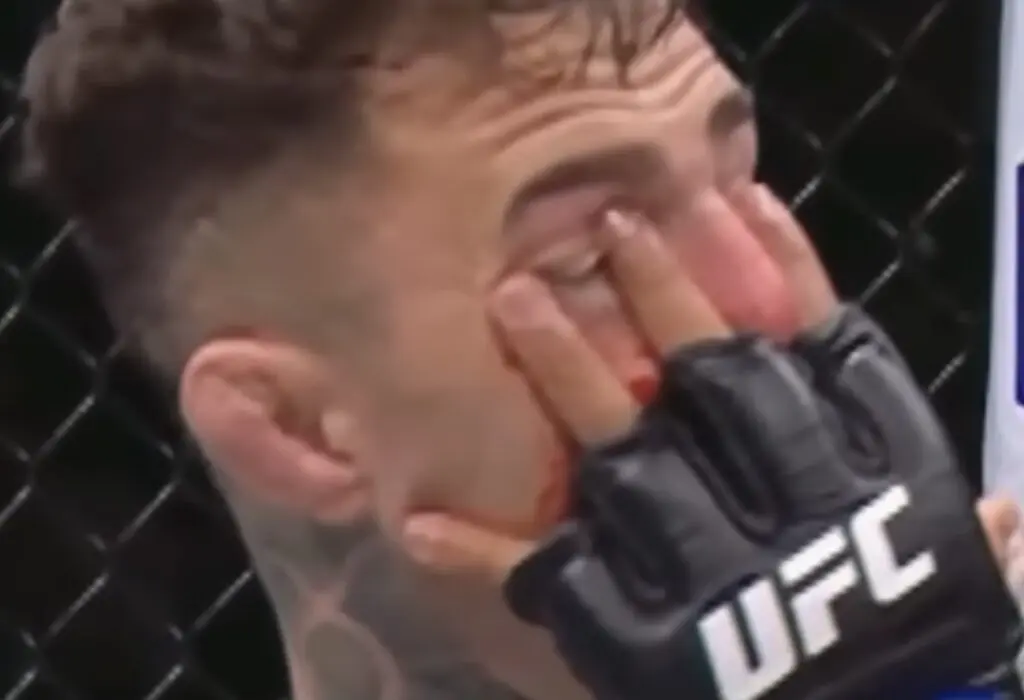 UFC