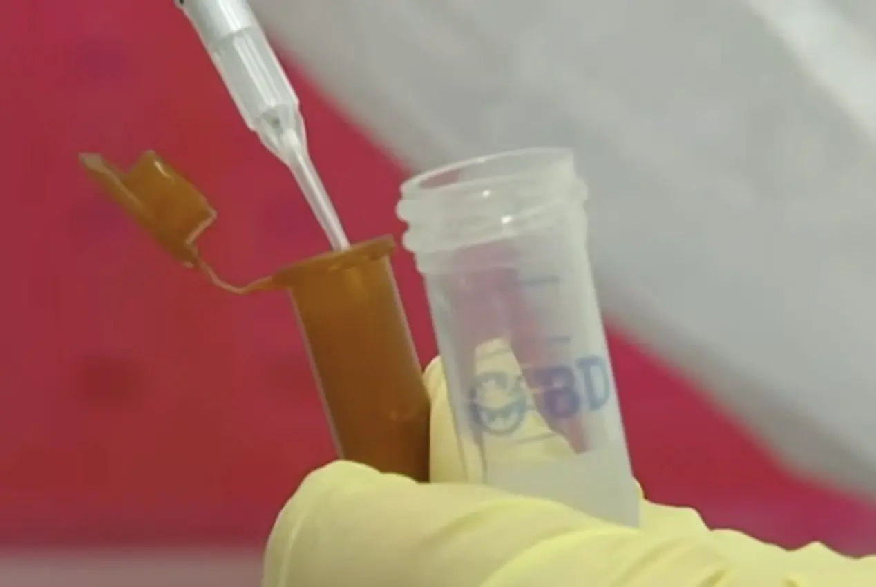 Chinese researcher pleads GUILTY to smuggling E. coli into the country