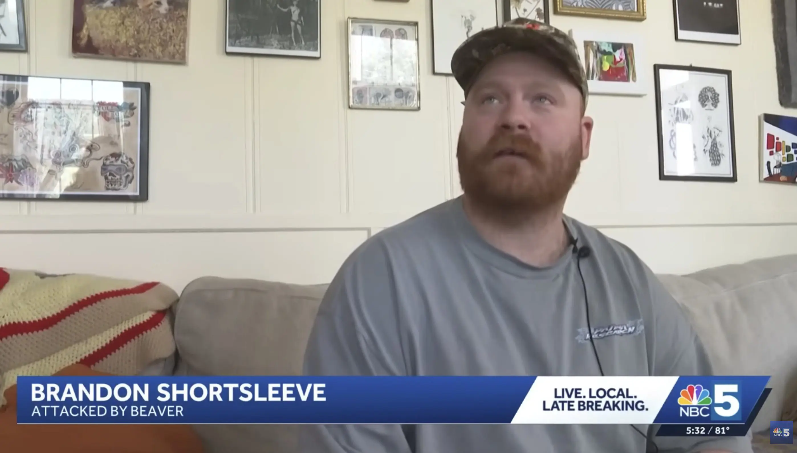 Burlington Man Hospitalized After Aggressive Beaver Attack at Lake George