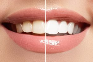 Evansville dentist